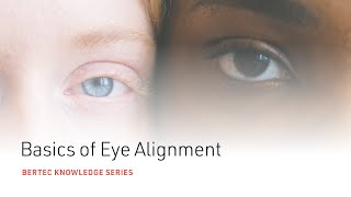 Bertec Knowledge Series Basics of Eye Alignment [upl. by Jewelle883]