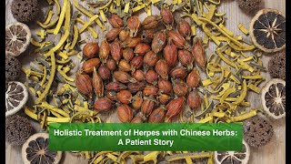 Holistic Treatment of Herpes with Chinese Herbs A Patient Story [upl. by Ytsirhc432]