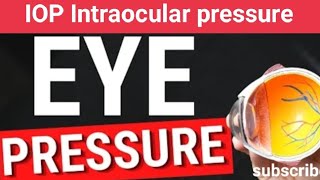 IOP Intraocular pressure  आंख का प्रेशर   Rudra Eye amp Health Care  in Hindi [upl. by Sucam]