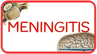 MENINGITIS  fisiopatología signo de Brudzinski y Kernig diagnóstico diferencial LCR y tratamiento [upl. by Eberly174]