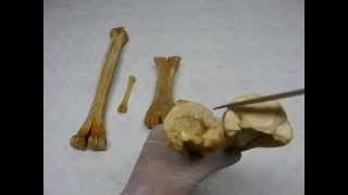 Metacarpal amp Metatarsal bones by dr khaled shoghy [upl. by Maroney]