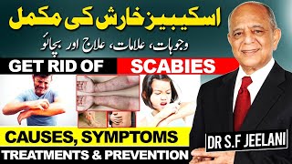 Scabies  Causes Symptoms Treatments amp Preventionखुजलीاسکیبیز کی خارش سے مکمل نجات drjeelani [upl. by Sredna]