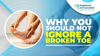 Why You Should Not Ignore a Broken Toe [upl. by Dorca503]