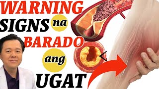 Warning Signs ng Barado ang Ugat Alisin ang Bara  Payo ni Doc Willie Ong [upl. by Anoyek]