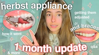 1 month HERBST Appliance amp BRACES update 🦷💗 how its going qampa etc [upl. by Tan259]