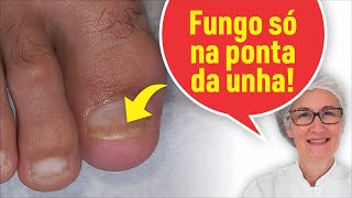 FUNGO SÓ NA PONTA DA UNHA [upl. by Silloc]