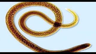 Parasitología  Trichinella spiralis Triquinosis  100624 [upl. by Aihtnys]