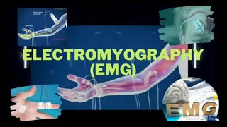 Electromyography  Electromyograph  Electromyogram  EMG  EMG Test  EMG Procedure [upl. by Pirnot]