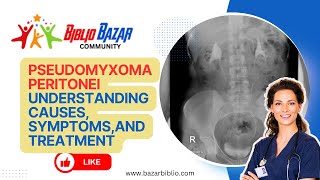 Pseudomyxoma Peritonei Explained Symptoms Treatment and Care 🏥  Rare Abdominal Condition [upl. by Morentz]