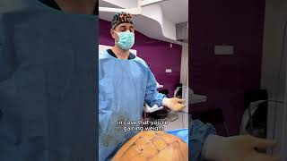 Dr Levy  Explains 4K HighDefinition Abdominal Liposuction made with VASER PRO [upl. by Alyahc952]