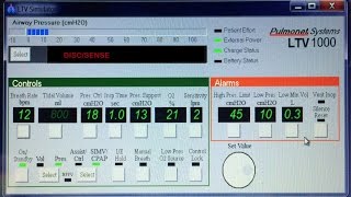 DISCSENSE ALARM ON THE LTV VENTILATOR [upl. by Margaret777]