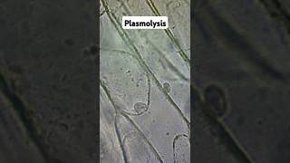 Plasmolysis and Osmosis biology gcse [upl. by Lamak168]