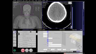 CT Cerebral Angio Full Work Process SIEMENS in syngo acquisition workplace [upl. by Dianemarie]