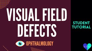 Visual Field Defects  Medical Tutorial [upl. by Pleasant]