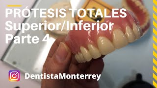 PASOS Prácticos PrótesisTotales👅Parte4 Prueba dientesAjustesPrótesisTerminada DentaduraCompleta [upl. by Thessa]