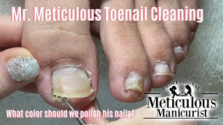 Shortn Sweet  Mr Meticulous Satisfying Impacted Toenail Cleaning [upl. by Stulin430]