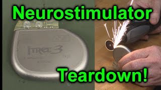 EEVblog 1027  Implantable NeuroStimulator Teardown [upl. by Fiore]