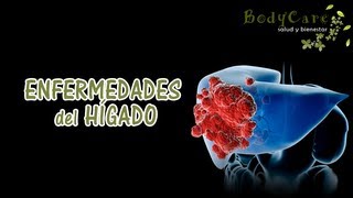 Enfermedades del hígado [upl. by Agace]