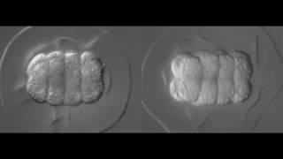 Developing bryozoan embryos animalvegetal views [upl. by Wing]