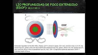 ABERRACIONES ÓPTICAS CLASES DE REFRACCIÓN DEL INO [upl. by Aynos]