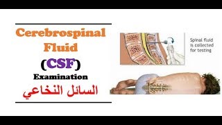 Clinical Chemistry  Cerebro  Spinal Fluid CSF Examination [upl. by Erdna]