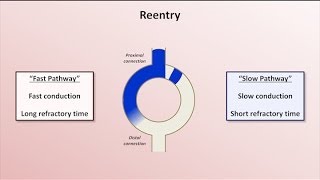 Intro to EKG Interpretation  Mechanisms of Tachyarrhythmias [upl. by Akemet16]