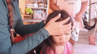 Picking Lice and Nits in Hair  Gross or Satisfying [upl. by Acsirp]