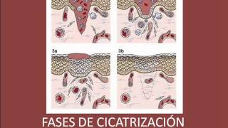 Fases de Cicatrización de las heridas [upl. by Clifford]