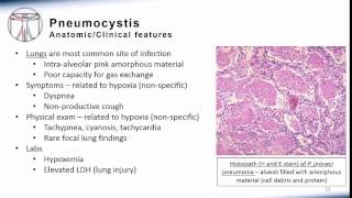 5 Pneumonia Pneumocystis [upl. by Aicil]