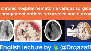 chronic subdural hematomaEnglish lecture evaluation various surgical treatment options and outcome [upl. by Tilden850]