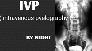 IVP  Intravenous pyelography  procedure in hindi  IVP Procedure [upl. by Blackman]