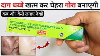 Betnovate N Skin Cream Review 2024  betnovate n  how to use betnovate n cream on face [upl. by Gnues21]