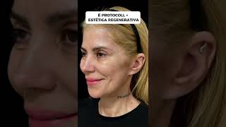 ISSO NÃO É FENOL rejuvenescimentofacial harmonizacaofacial hof esteticaregenerativa pele [upl. by Accebber25]