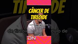 Câncer de tireoide Quando desconfiar endocrinologia tireoide cancer [upl. by Seiber]