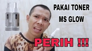 Pakai Toner Ms Glow Wajah Kok Jadi Perih Kenapa [upl. by Tremain]