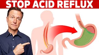 How to STOP Acid Reflux Instantly [upl. by Barbe]