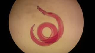 Adult male of Schistosoma haematobium [upl. by Ianahs]