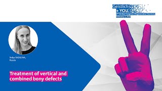 Treatment of vertical and combined bony defects by Sofya Sadilina Russia [upl. by Munmro]