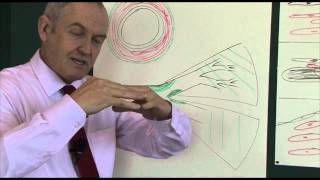 Heart disease 6 Pathophysiology of coronary heart disease [upl. by Suinuj]