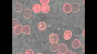 Babesia bovis merozoite egress from a red blood cell [upl. by Egin]