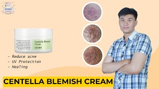 COSRX Centella Blemish Cream untuk jerawat ampuh produk korea [upl. by Latterll]