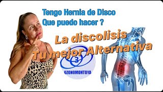 Ozonoterapia en la Hernia de disco [upl. by Margery]