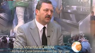 Prof Dr Ahmet Murat ÇAKMAK Hipospadias [upl. by Ailenroc]