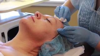 Micropeel Demonstration [upl. by Syl]