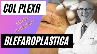 Blefaroplastica non chirurgica col PLEXR [upl. by Issim]