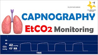 Capnography  ETCO2 Monitoring [upl. by Wera515]