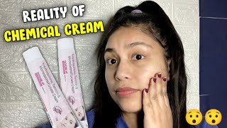 Elosone HT cream review  Best cream for PigmentationDarkspottanningmelasma Elosone HT review [upl. by Rona56]