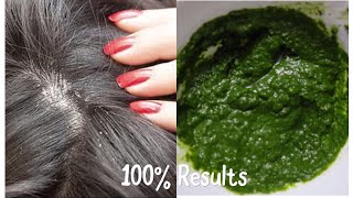 BEST SEBORRHEIC DERMATITIS SCALP TREATMENT  AYURVEDIC DANDRUFF TREATMENT 100 RESULTS IN ONE USE [upl. by Hollingsworth]