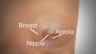 Mastectomy  Breast Reconstruction Overview [upl. by Dodds]