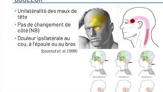 Quel est le profil des patients qui présentent une céphalée cervicogénique [upl. by Venita360]